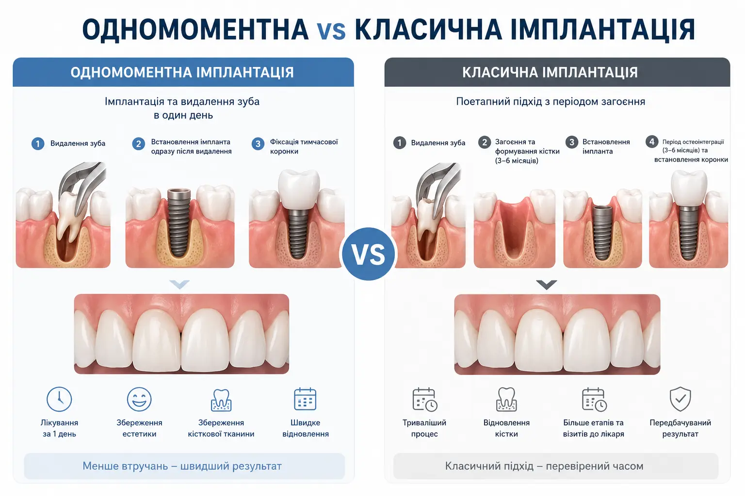 Одномоментна vs класична імплантація Одномоментна vs класична імплантація